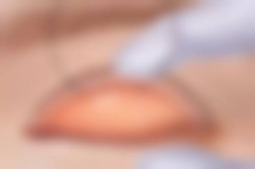 毛发种植效果好不好啊？真实案例告诉你，95%的人术后满意度高，植发让你颜值逆袭不是梦！ 