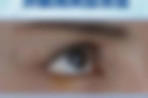 注射后注意事项