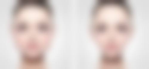 种植头发那家比较好？揭秘3大口碑医美机构，技术先进、效果显著，助你重拾浓密秀发！ 