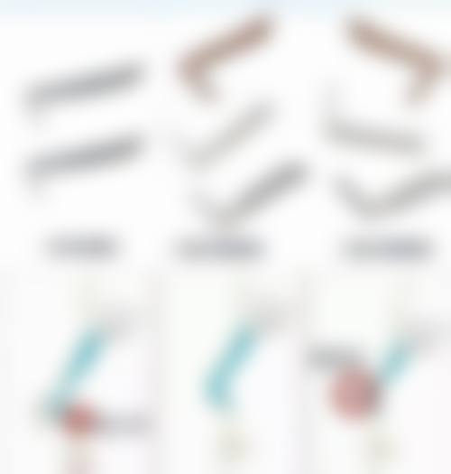 如何选择正规的毛发种植机构