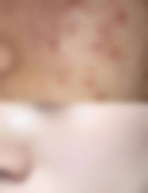 【郎丽娟医生擅长项目：】