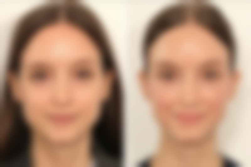 【郎丽娟医生怎么预约挂号？】