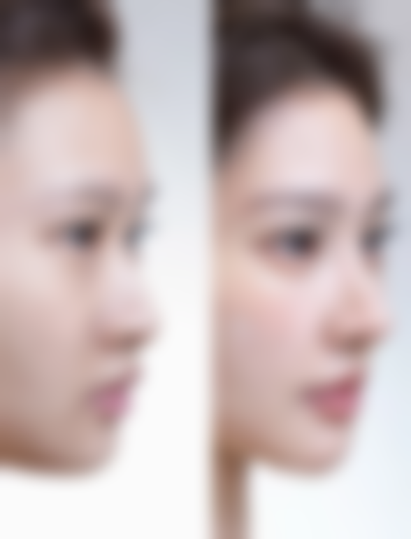 顾客可通过电话或医院法定网站进行预约，这样能确保就诊时得到及时的服务和专精的询问。提前预约可以让您的就诊过程更加顺畅，节省时间。