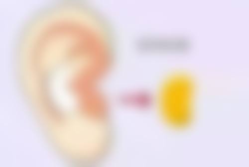 瘦脸针国产进口有啥区别