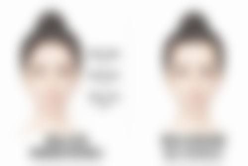 瘦脸针的成效如何