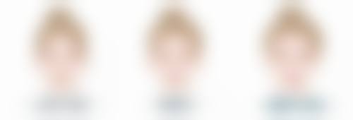 瘦脸针进口和国产的价格