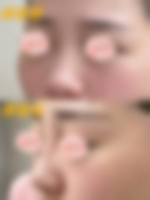 【薛媚医生擅长项目】