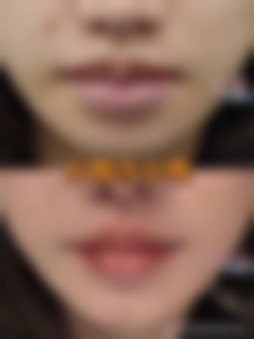 【南京美莱整形医院地址：】