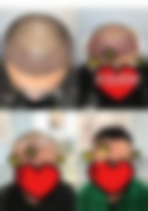 【吕虎医生怎么预约挂号？】