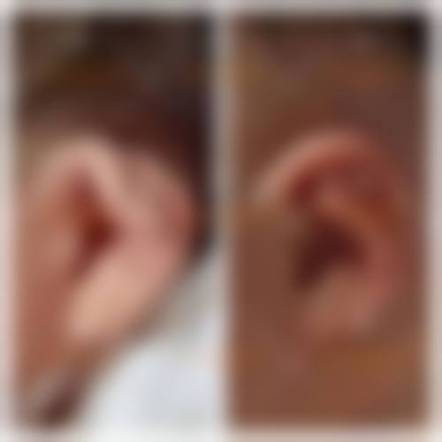 【北京卓新华星整形医院参考价格表:】