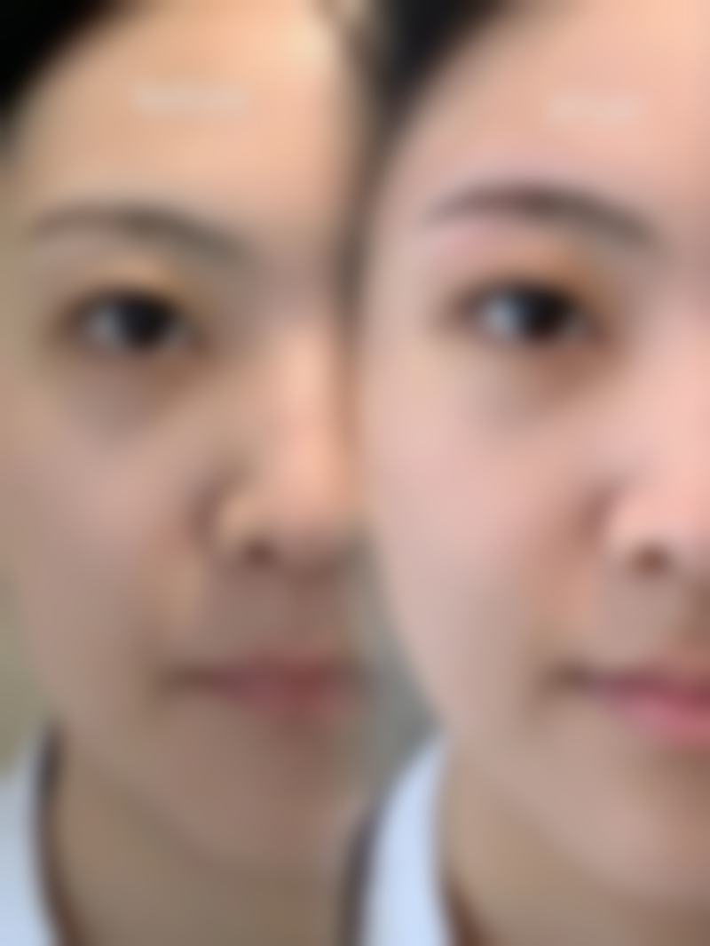 在选择整形美容医院时，除了关注医院的硬件设施和技术水平，医院的服务质量也是非常重要的。肇庆西江医院整形美容科以患者为中 心的服务理念，能够让患者在整个治疗过程中感受到尊重和关怀。从预约挂号到术后回访，每一个环节都体现了医院对患者的用心。