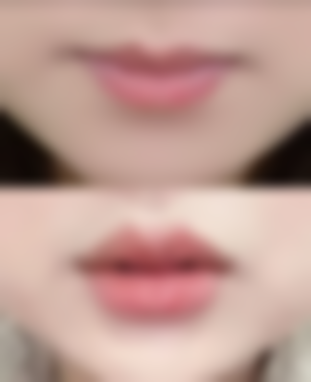 【乌兰察布美尚美整形医院特色项目：】