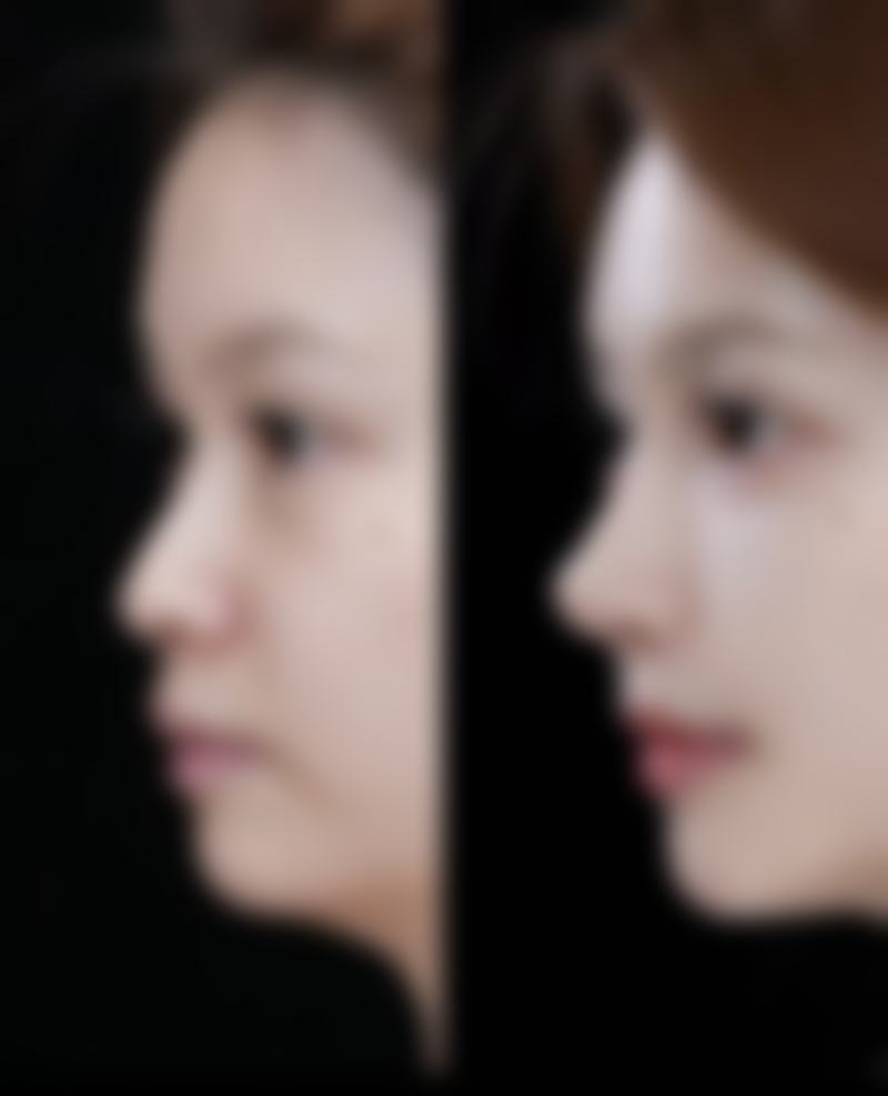 【乌兰察布美尚美整形医院是正规的吗?】