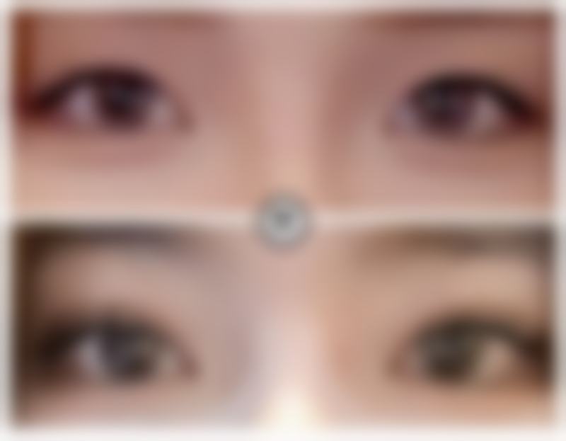 【薛媚医生口碑】