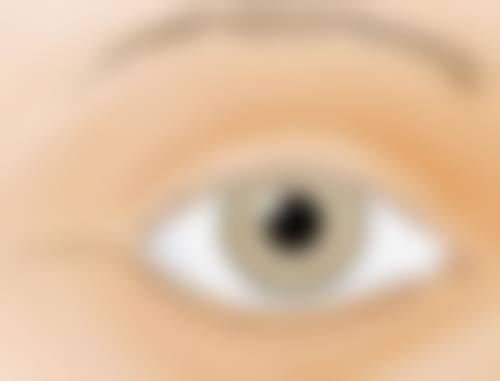 二、下颚骨整形的过程是这样