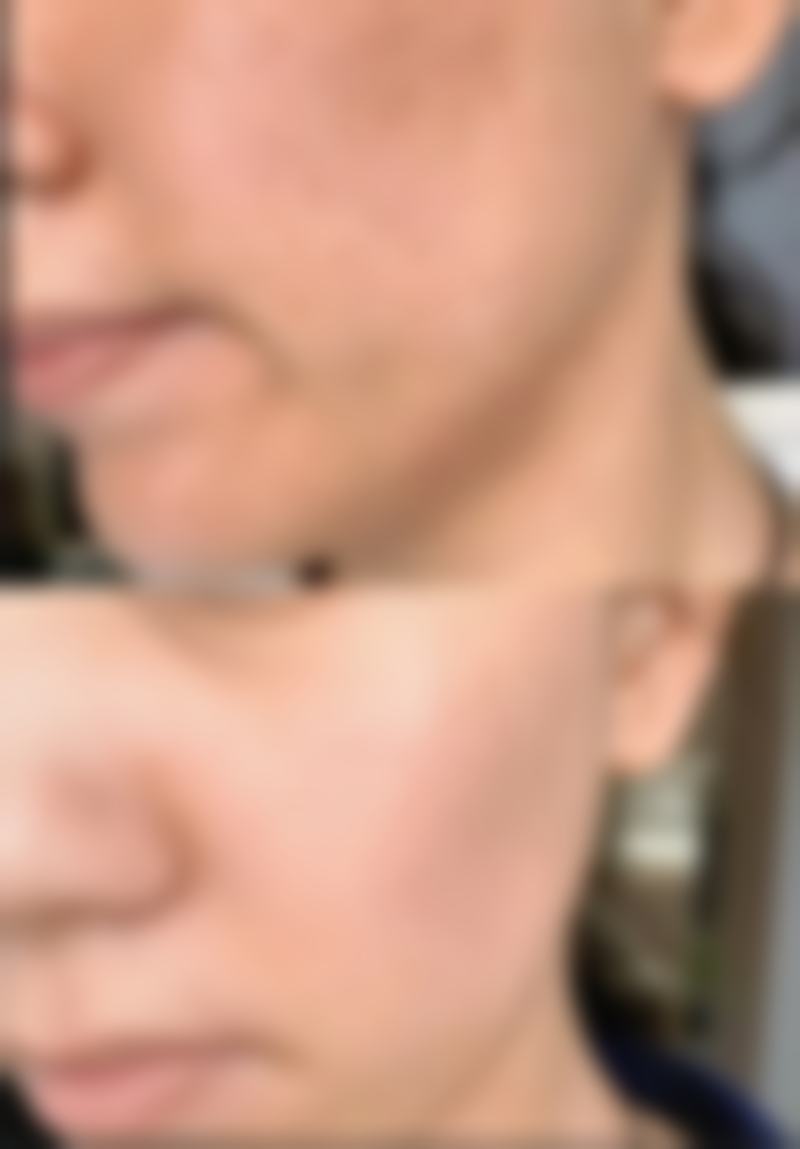 【纳雍新立医院特色项目：】