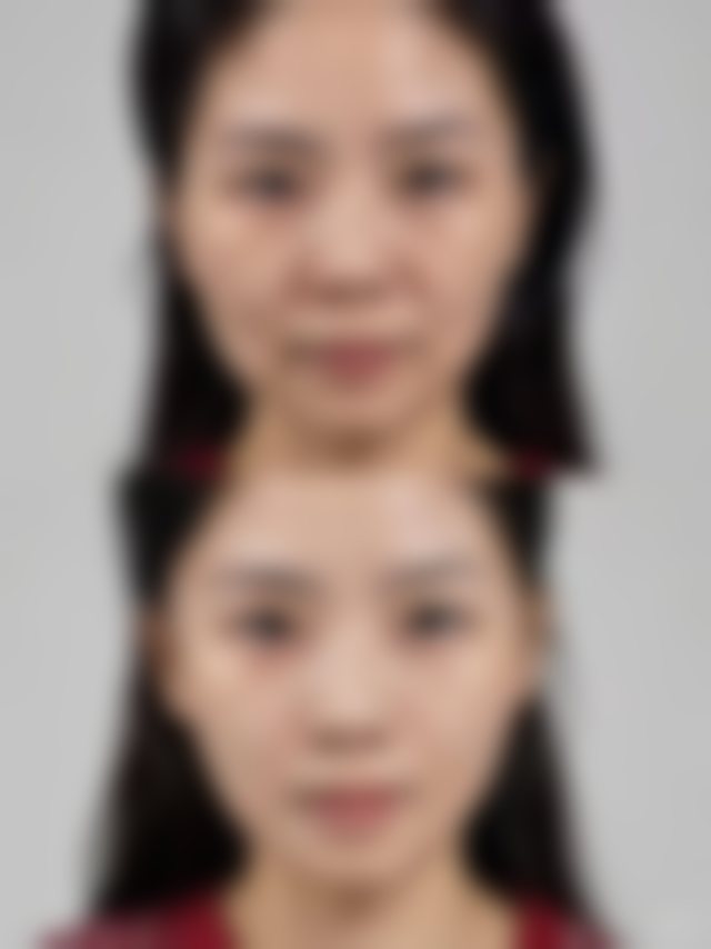 【烟台光盈汇美医疗美容诊所患者口碑评价：】