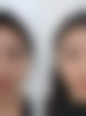 【鄂尔多斯赵志明医疗美容诊所患者口碑评价:】