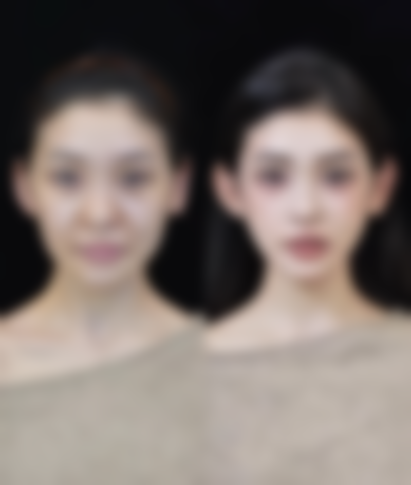 五、下颌骨整形术危险吗