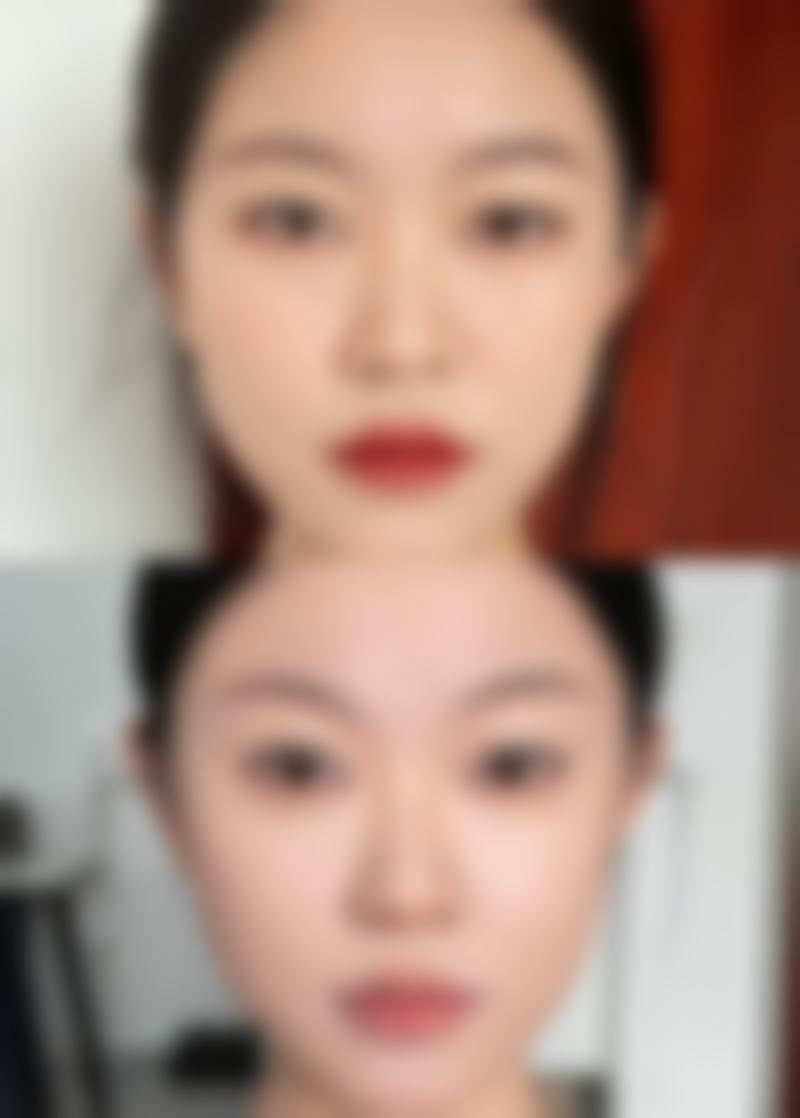 种植毛发危险吗