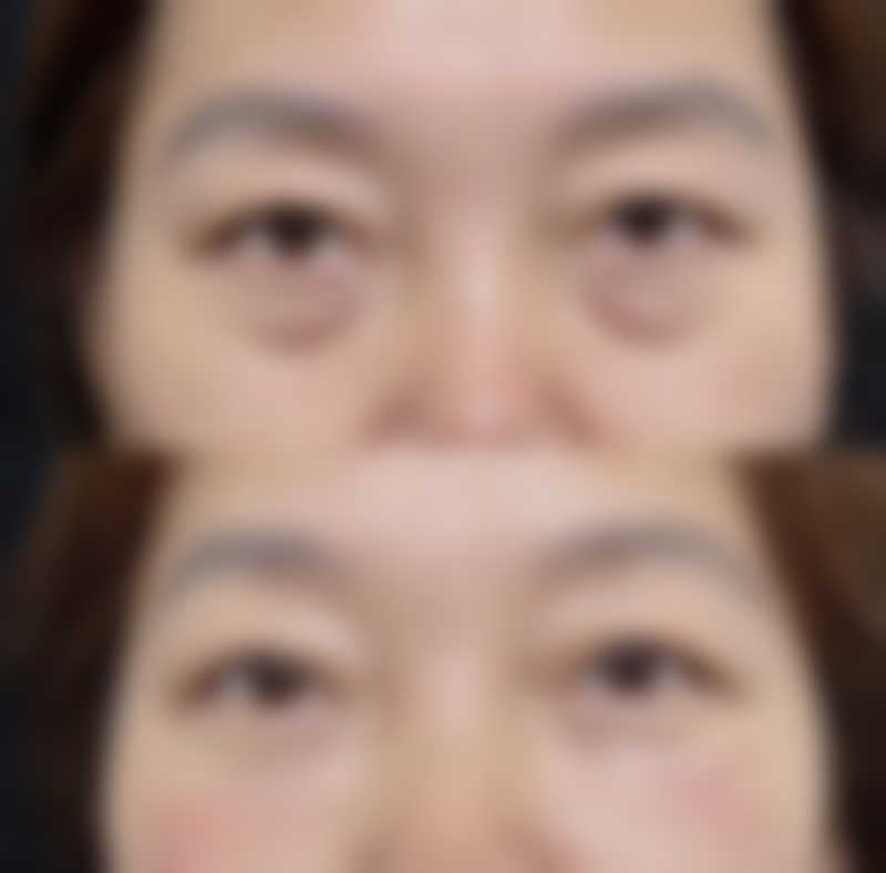 【成都科思研整形医院是正规的吗?】