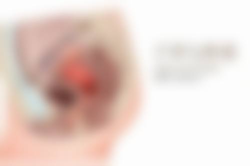 阴道紧缩术多久能修复