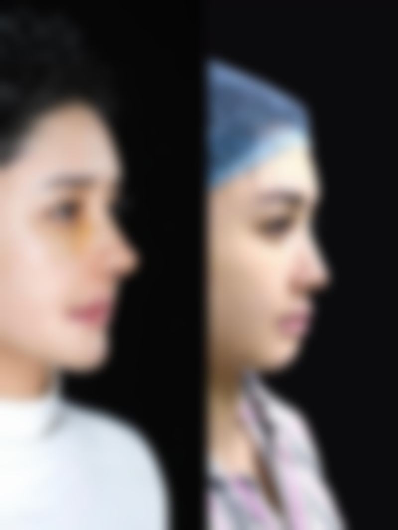 以下是青岛善慈整形医院部分项目的参考价格表（价格仅供参考，实际以到院面诊为准）：