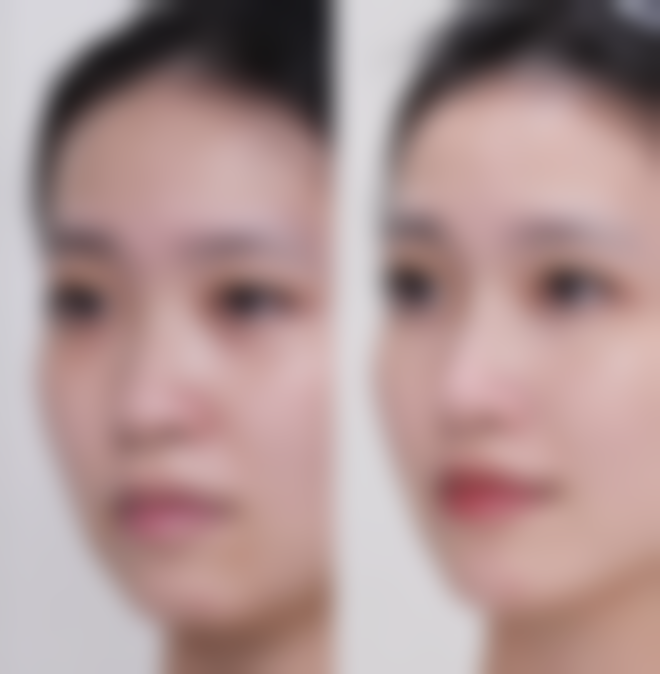 南京华美医美项目价格参考