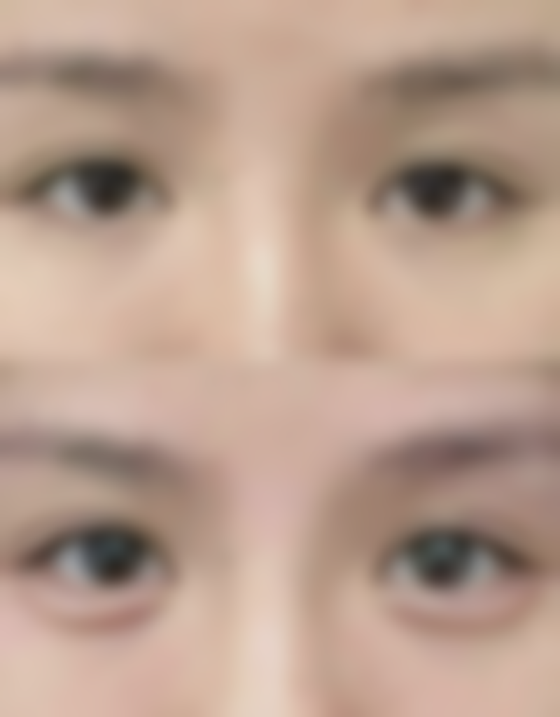 东营医联美医疗美容诊所是一家正规的私立医疗美容机构。它具备开展医疗美容服务所需的相关资质，在合法合规的前提下为客户提供专精的美容服务。从设备的引进到人员的配备，都严格按照相关标准执行，让客户能够放心地在这里进行美容项目。