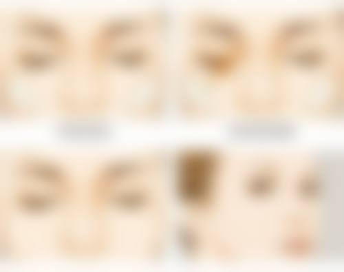 打完瘦脸针注意事项有哪些呢