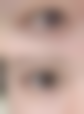 【碧莲盛·不剃发植发国内连锁（兰州分院）参考价格表：】