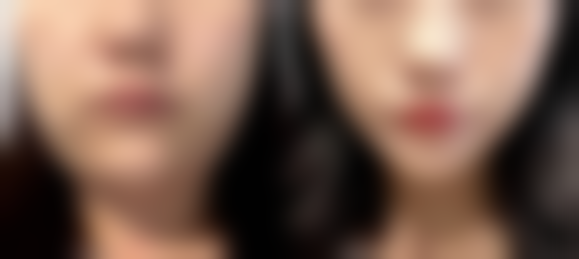 【成都武侯丹凤眼整形医疗美容诊所怎么预约挂号?】