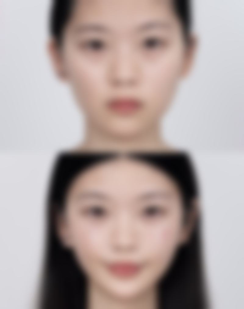 小脸针和瘦脸针哪个成效好