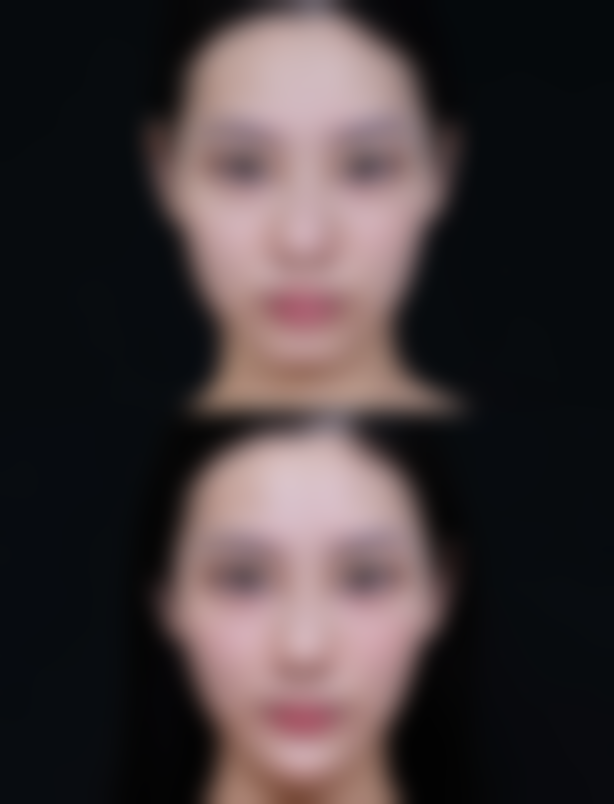 【香港YATAI雅太医疗美容医院患者口碑评价：】