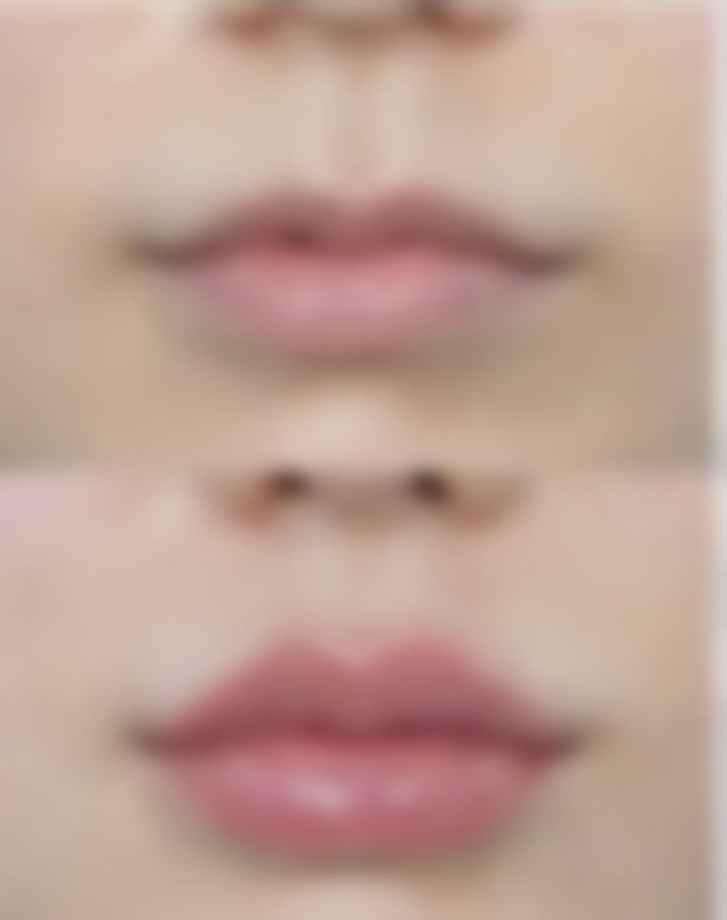 小脸针和瘦脸针一样吗