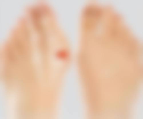 法令纹嘴角下垂松弛怎么改善