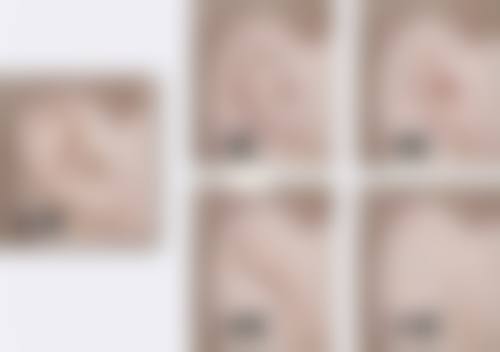 上海嘴唇疤痕修复价格参考