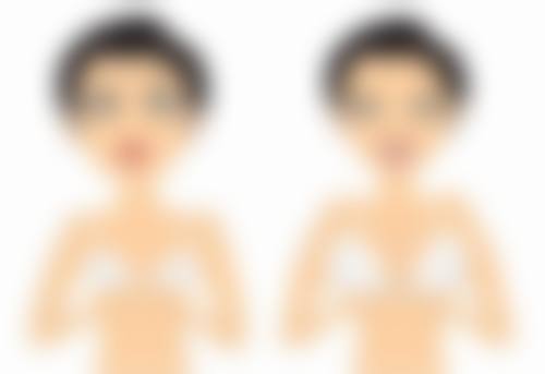 嘴唇上有道疤痕能去掉么?