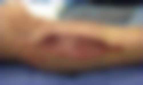 【戎新清医生口碑怎么样？】