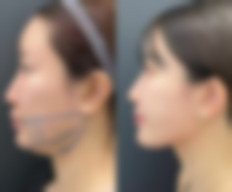 整形和整容有区别吗