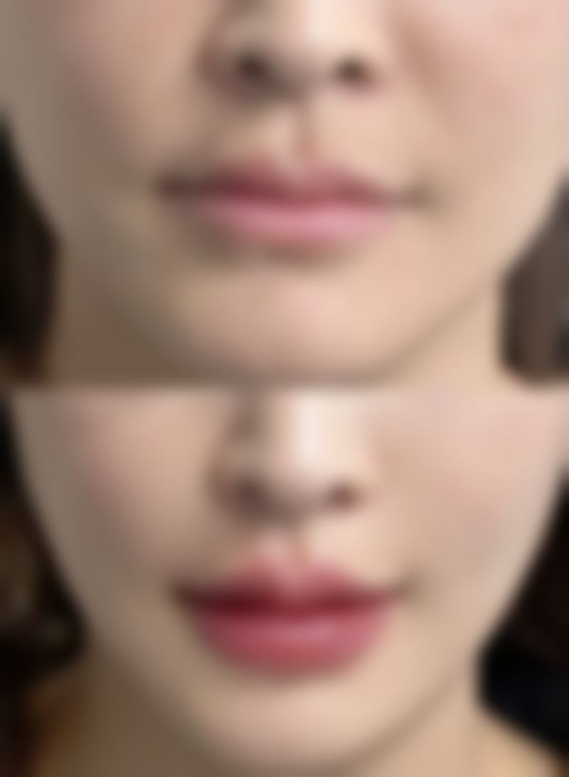 价格差异与适用人群