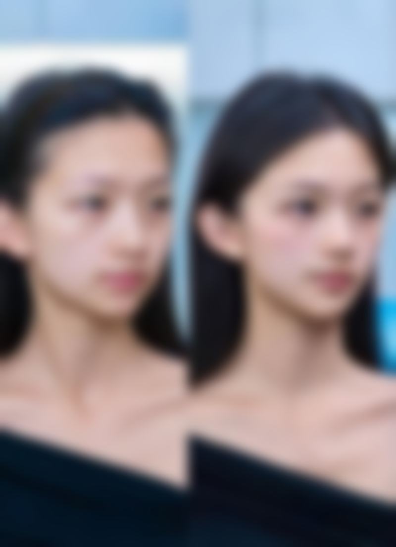 法令纹嘴角纹明显怎么办