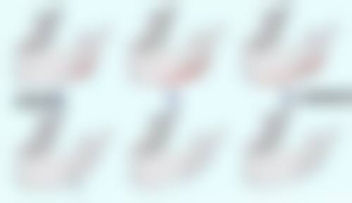 深覆合上嘴唇凸