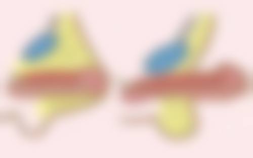 进口的瘦脸针有哪些牌子？揭秘3大热门品牌优势，助你轻松拥有精致小脸！ 