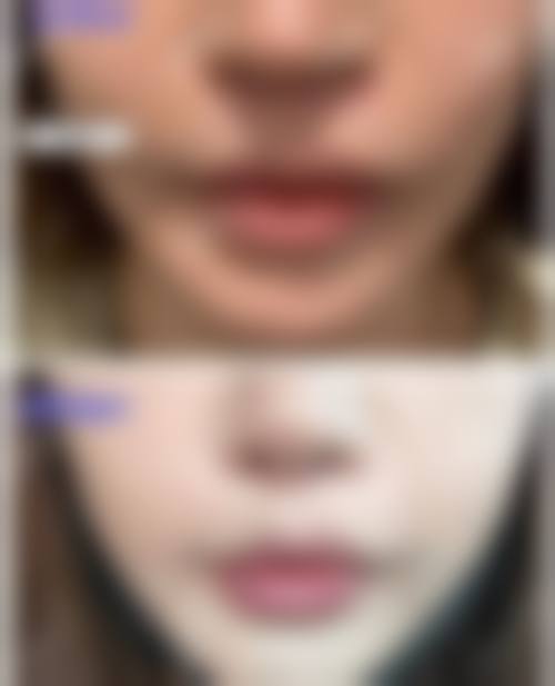 【郑州丽天整形医院地址:】