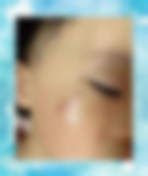 【陈雪医生怎么预约挂号?】