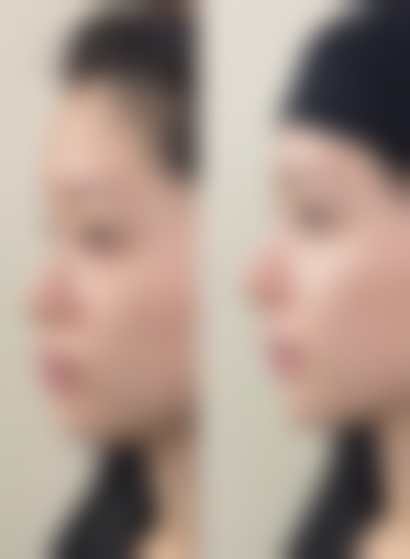 【武汉德美医疗美容门诊部是正规的吗?】