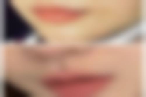 面部除皱有副作用吗?