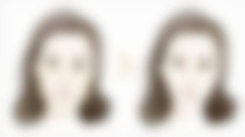 打美白针成效真实经历