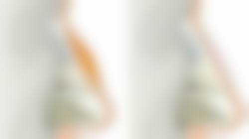 影响瘦脸针注射单位的因素